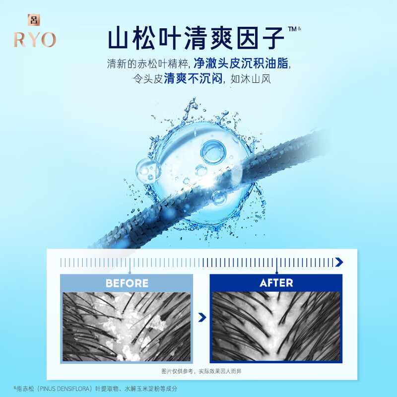 吕蓝吕洗发水400ml舒盈清润净澈去屑洗发水高清大图