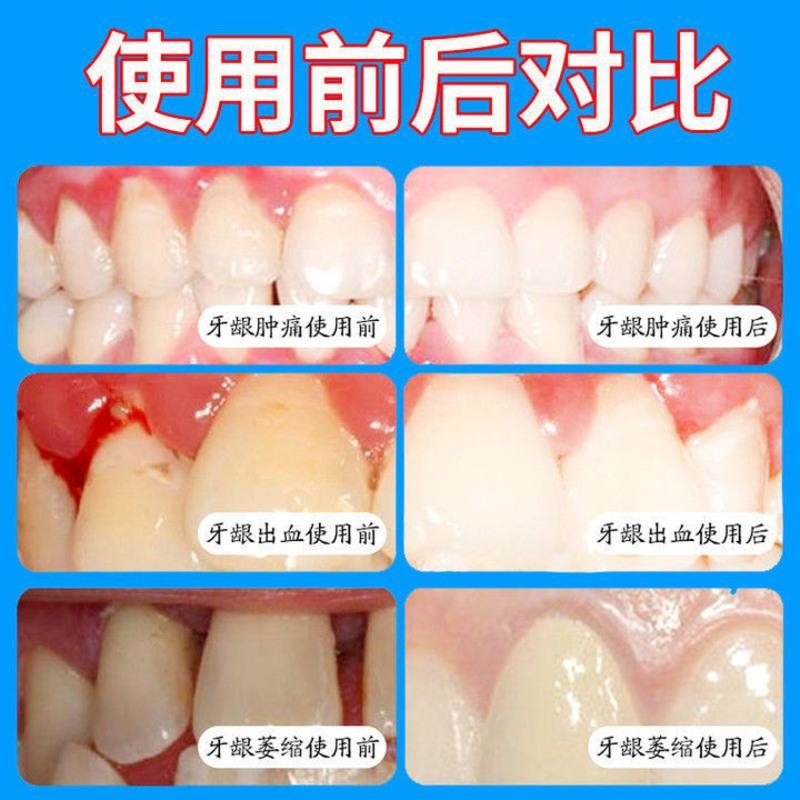 图书>期刊/杂志>男士>图书其它>牙龈萎缩修复牙齿松动牙龈肿痛出血