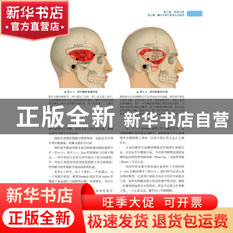 正版 癫痫外科手术技术 [美 ]Gordon H. Baltuch 中国科学技术出高清大图