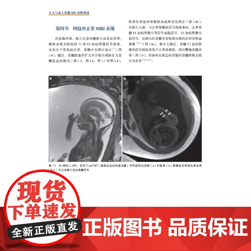 小儿与成人骨髓MRI诊断图谱 正常表现、变异和弥漫性病变 图文结合医学专著 广东科技出版社店发货高清大图