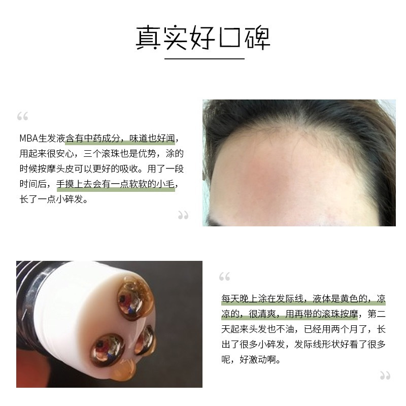 韩国进口MBA增发液生发液鱼腥草头皮护理精华液护发滚珠呵护头皮精华免洗润发精油20ml*2支