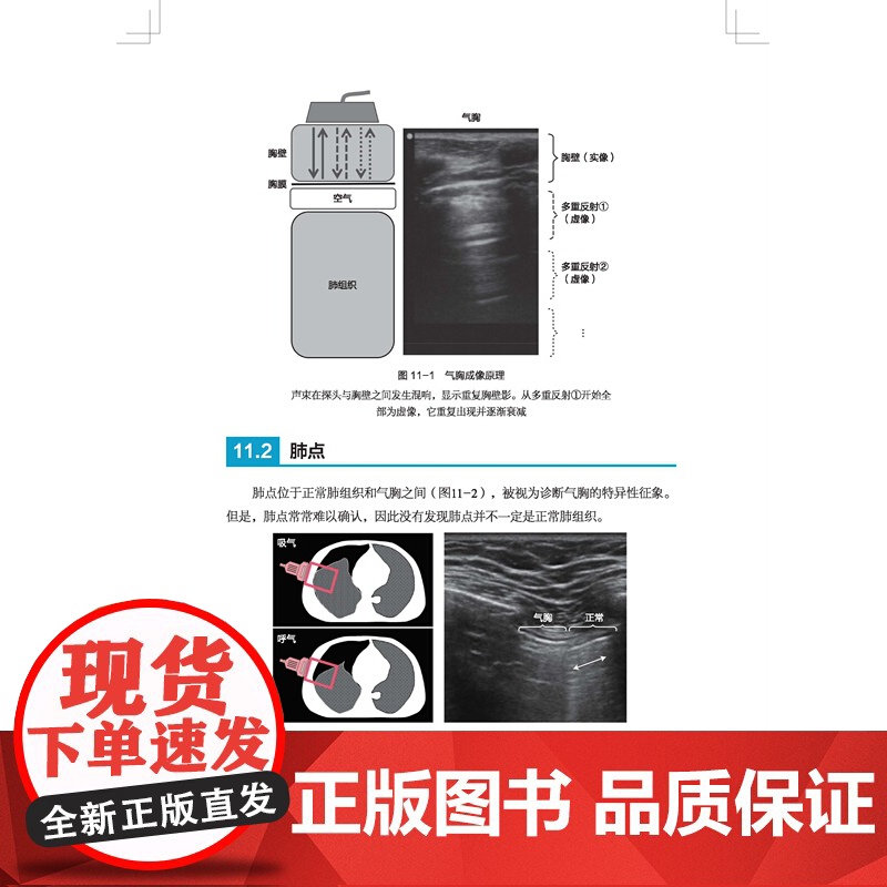 肺部超声 译者 朱强 主任医师 教授 首都医科大学附属北京同仁医院 黄慧莲 主治医师 首都医科大学附属北京同仁医院 北京高清大图