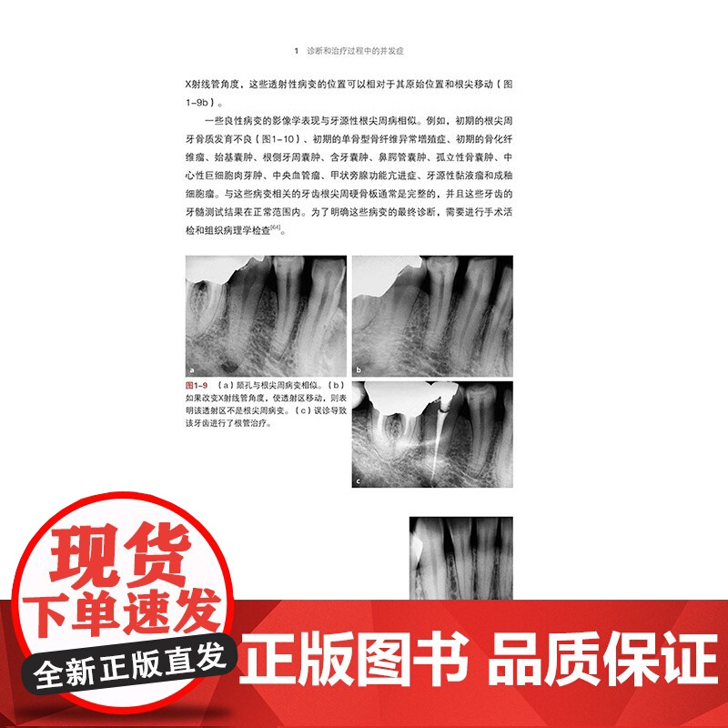[出版社]牙髓治疗并发症的管理 赵今 连冰洁 诊断和治疗过程中并发症 影像学检查过程中失误清理和成形 辽宁科学技术出版社高清大图