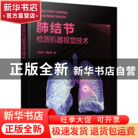 肺结节检测机器视觉技术