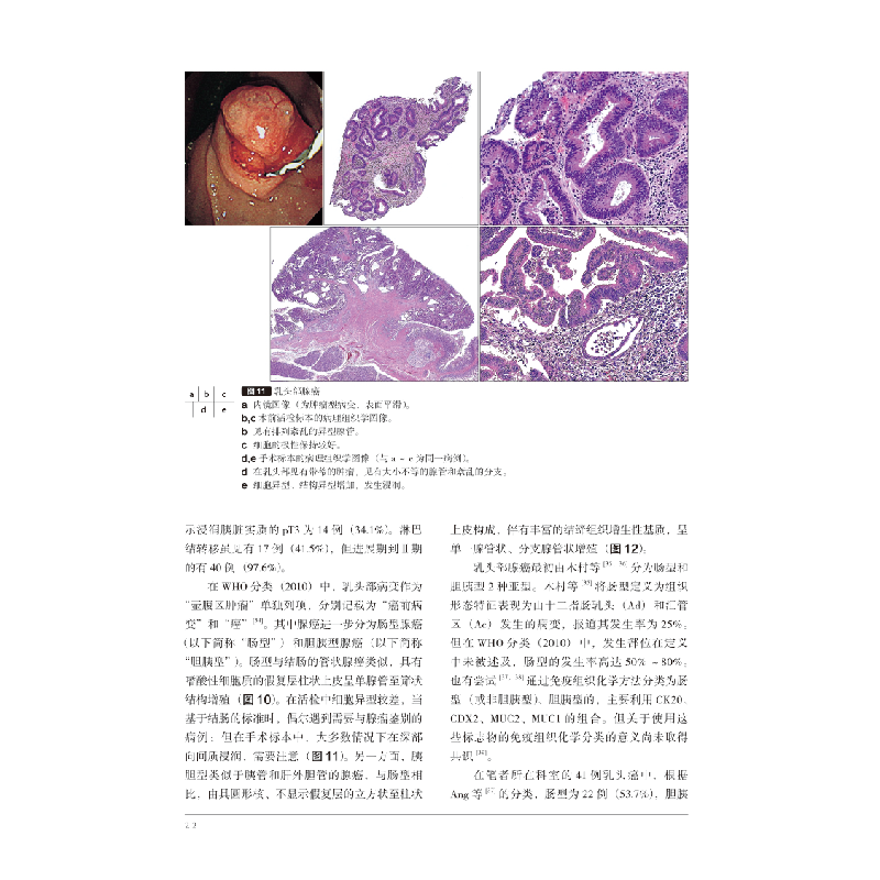 正版新书]胃与肠:希望大家了解的十二指肠病变(日)《胃与肠》编高清大图
