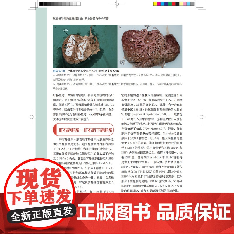 [店]腹腔镜外科局部解剖图谱:解剖路径与手术操作高清大图
