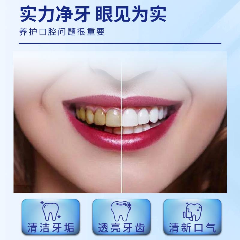 牙结石口腔喷雾去口臭去黄溶解牙垢牙渍烟渍异味清新口气高清大图
