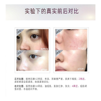 VIERRA 惟爱论 李小冉同款 澳洲正品抗糖美肌红石榴多酚抗糖口服液二代 50ml*8瓶/1盒 澳洲原装进口