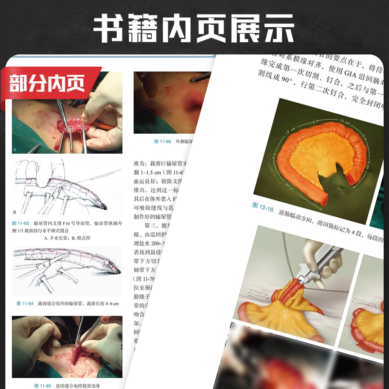 [正版]实用泌尿外科腹腔镜手术学 十三五重点出版物出版规划项目 张骞 李学松主编 腹腔镜肾手术 北京大学医学出版社 9高清大图