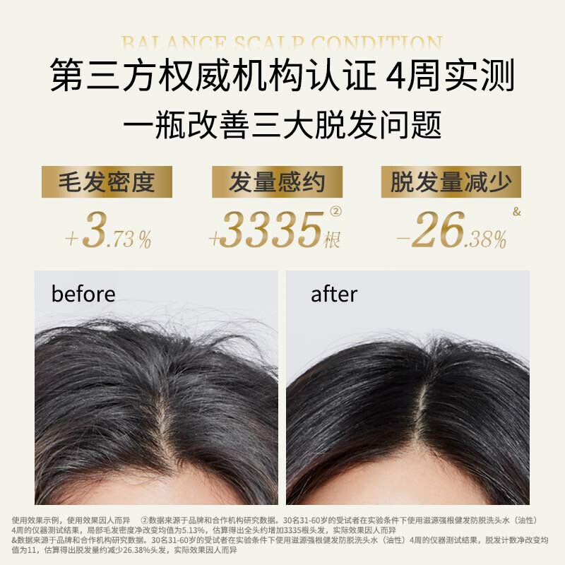 滋源SEEYOUNG无硅油洗发水控油蓬松头皮护理柔顺滋养修护发丝清爽不粘腻滋源-535ml生姜强根健发洗头水(油性)高清大图