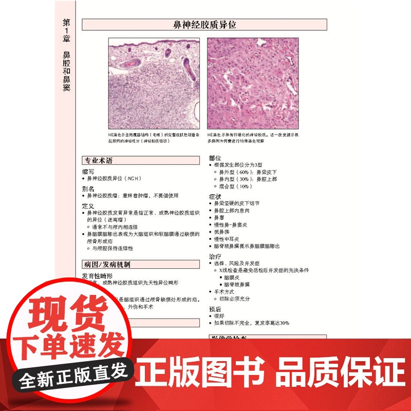 头颈诊断病理学 本书介绍头颈部的肿瘤性和非肿瘤性病变的病理诊断 北京科技高清大图
