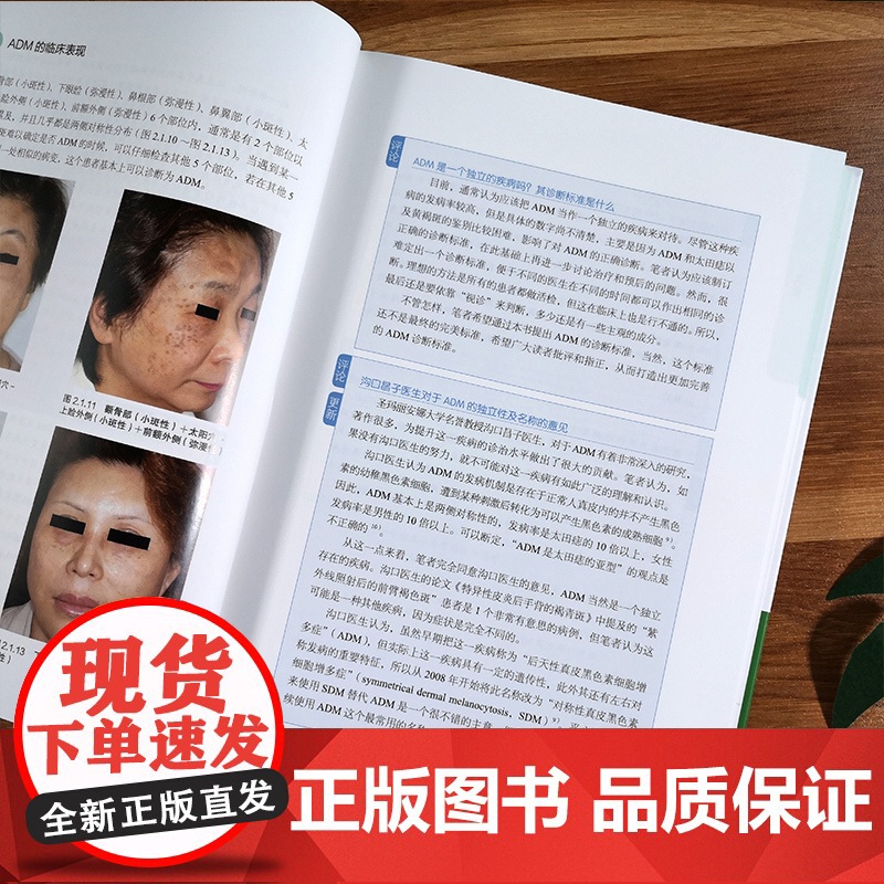 色斑的治疗第二版 葛西健一郎吴溯帆著面部整形美容医学科普讲解激光美容整形治疗脸部健康淡斑祛斑皮肤诊疗面部美白 整形美容书高清大图