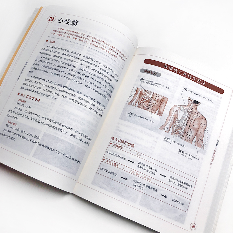 [醉染正版]超简单拔罐消百病全书 后疫情时代,居家养生常用拔罐流程一目了然细致图解取穴不再难一技在手护全家家庭保健养生书高清大图