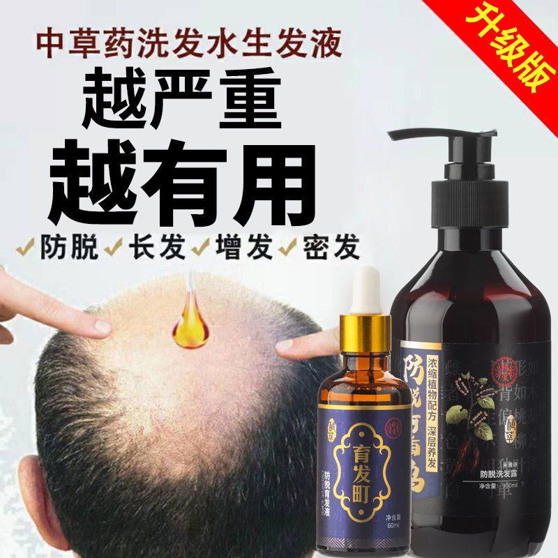[优先发货][快速长发]防脱发洗发水纯生发增发密发斑秃脂溢性育发液防发 3周期装(严重脱发使用)