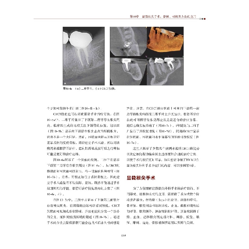 醉染图书现代根管外科理论与实践9787559115324高清大图