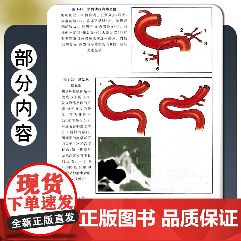 [央视网]脑血管病和神经介入技术手册 第三版 汇聚全球新领域发展进程及参考案例 该医学领域从业者不可不读的专业参考书ZK高清大图