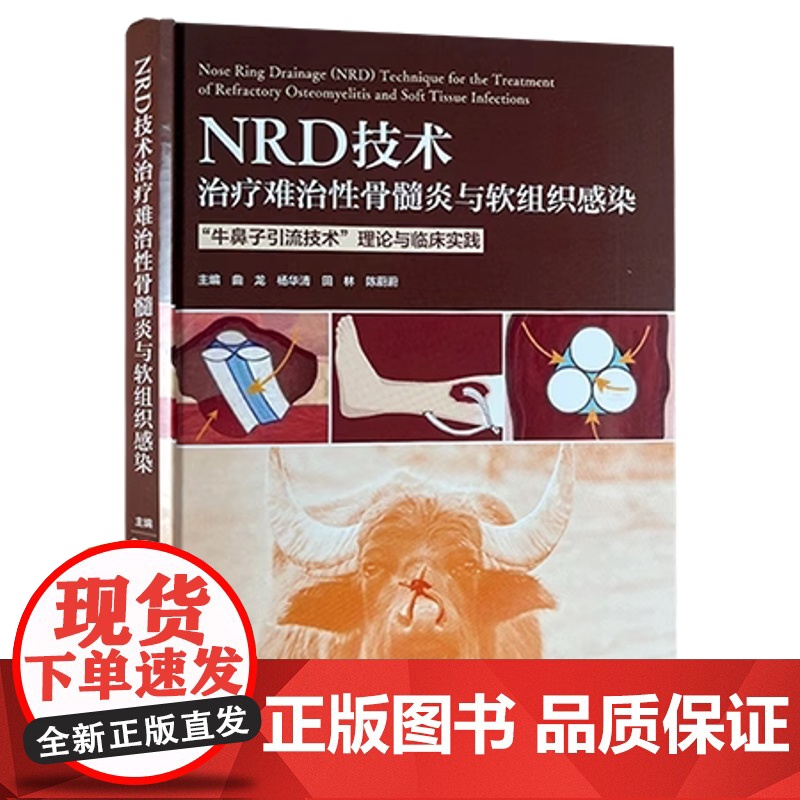 NRD技术治疗难治性骨髓炎与软组织感染牛鼻子*技术 理论与临床实践 曲龙 杨华清 田林 陈蔚蔚 主编 北京大学医学出版社高清大图