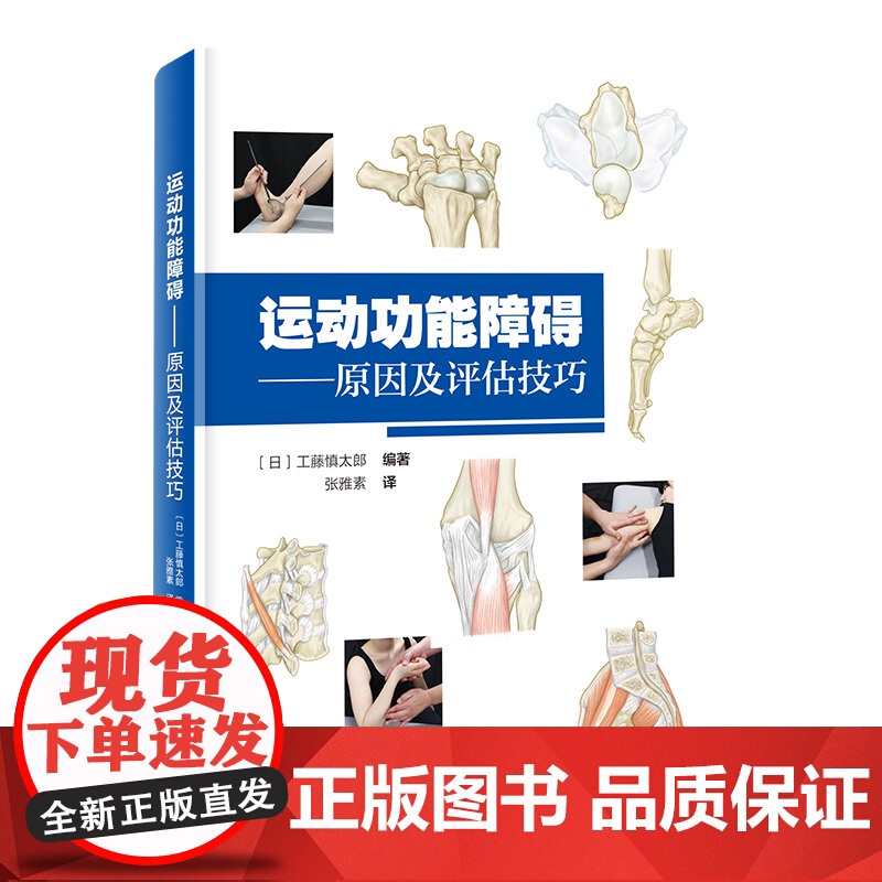 运动功能障碍 原因及评估技巧 康复 运动功能 评估 肌骨 疼痛 北京科学技术高清大图