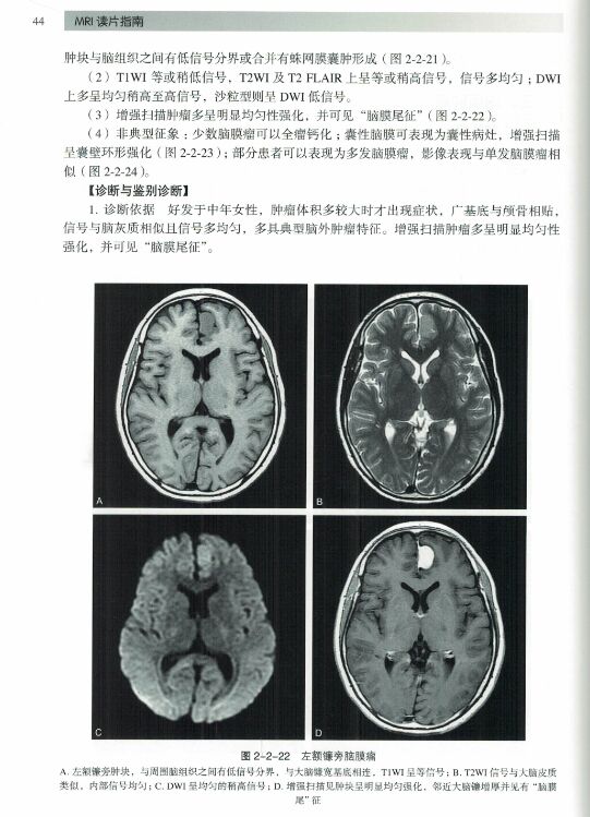 [正版] MRI读片指南 临床影像诊断丛书 夏黎明 邵剑波 孙子燕主编 可搭CT读片指南 北京大学医学出版社97875高清大图