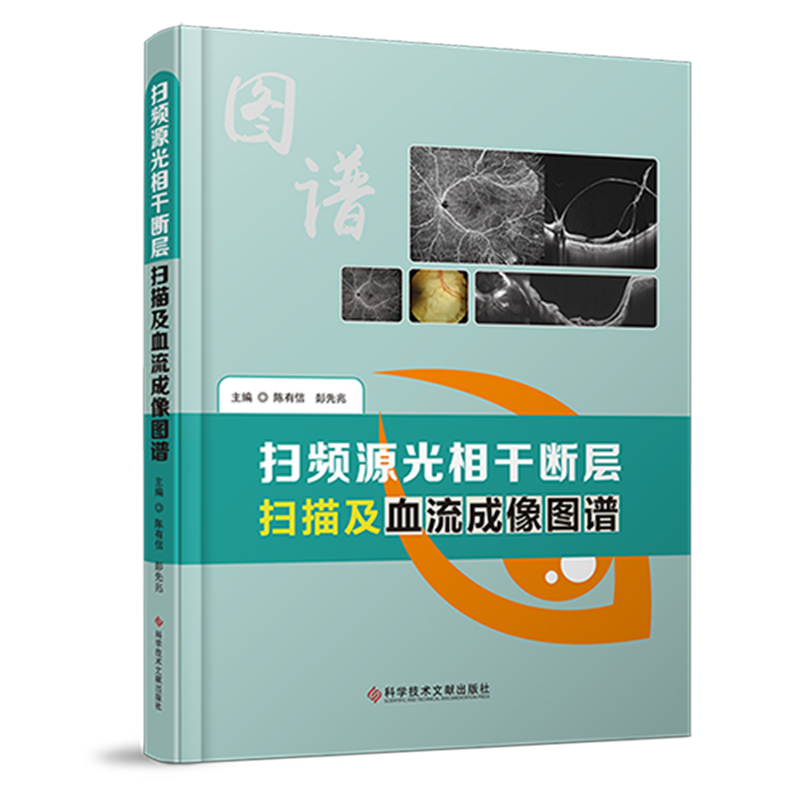 [醉染正版]正版 扫频源光相干断层扫描及血流成像图谱 眼病影像诊断图谱 临床医学书籍 科学技术文献出版社高清大图