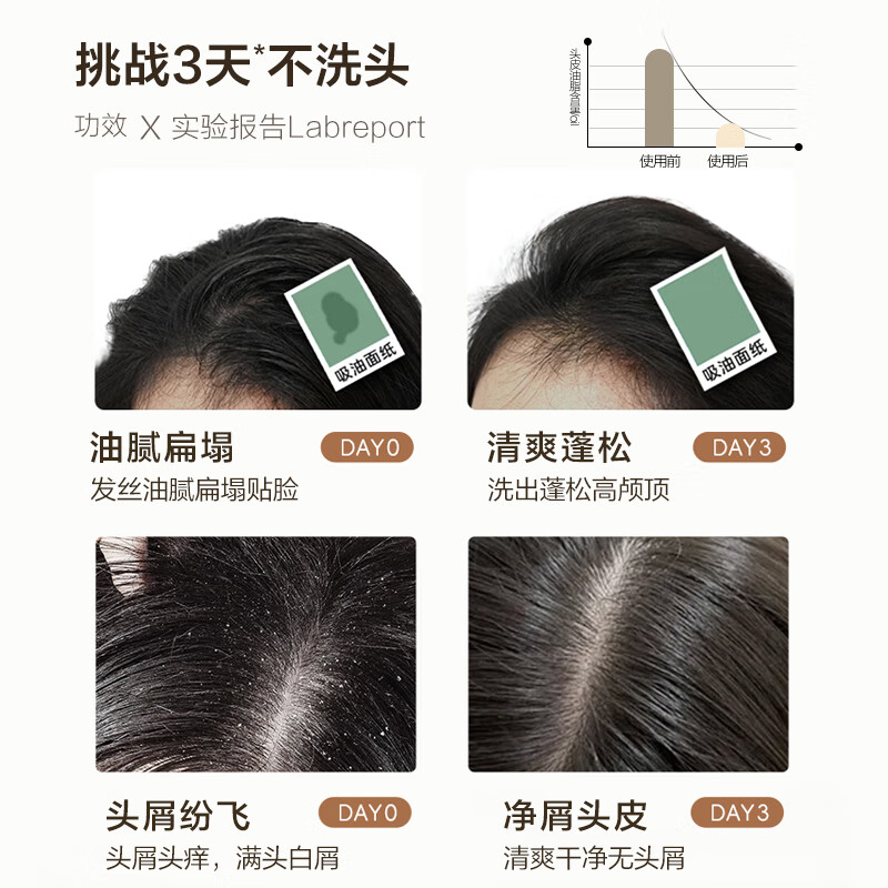 柏缇平衡净屑双效洗发水 515ml 去屑止痒净澈蓬松留香男女通用洗发露高清大图