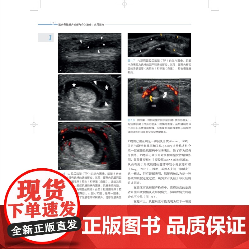 肌肉骨骼超声诊断与介入治疗实用指南 临床医生超声操作指南上海科学技术出版社临床医学外科学肌肉骨骼介入运动医学关节外科高清大图