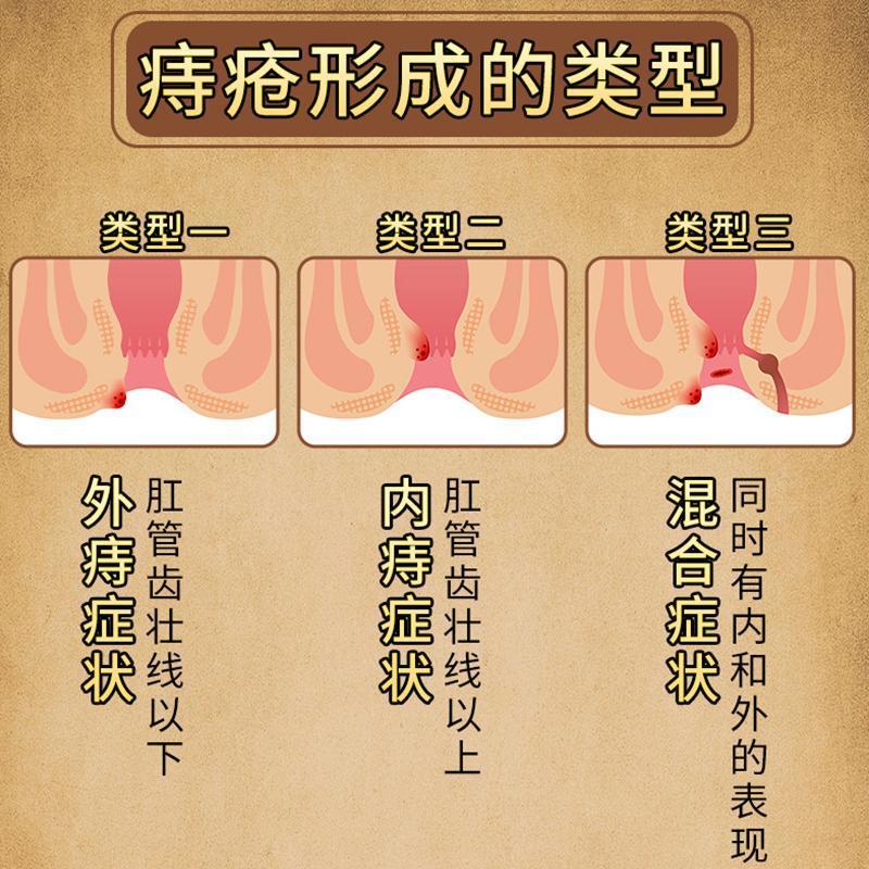 [2盒装]药房直售 康速达 痔立克 冷敷凝胶痔疮膏正品官方旗舰 适用于痔疮引起的轻度疼痛充血 膏药高清大图