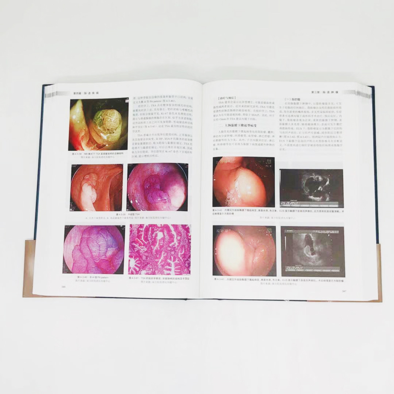 [正版]消化病学 实用消化道内科学书籍内镜系统疾病高级教程胃肠镜诊断图谱京都胃炎分类病理参考书陈旻湖杨云生唐承薇著 97高清大图