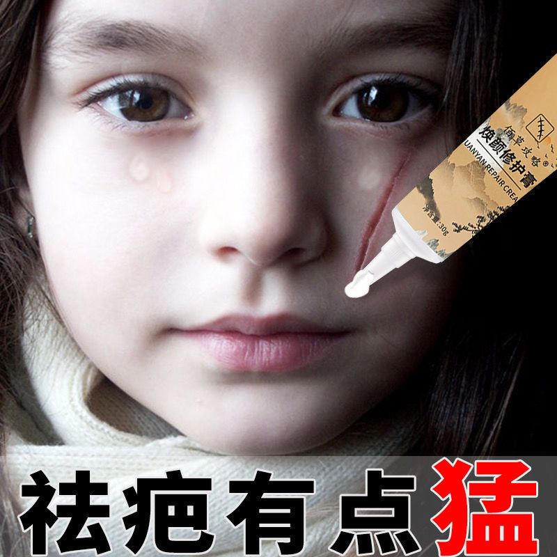 [快速去疤]淡化增生凹凸疤妊娠纹去新老疤烧伤痘印疤膏修复无痕 升级装一瓶装