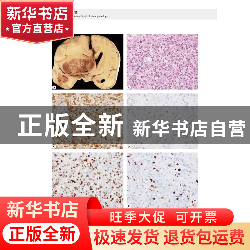 正版 神经病理诊断精要 [印]Chitra Sarkar 中国科学技术出版社 9高清大图