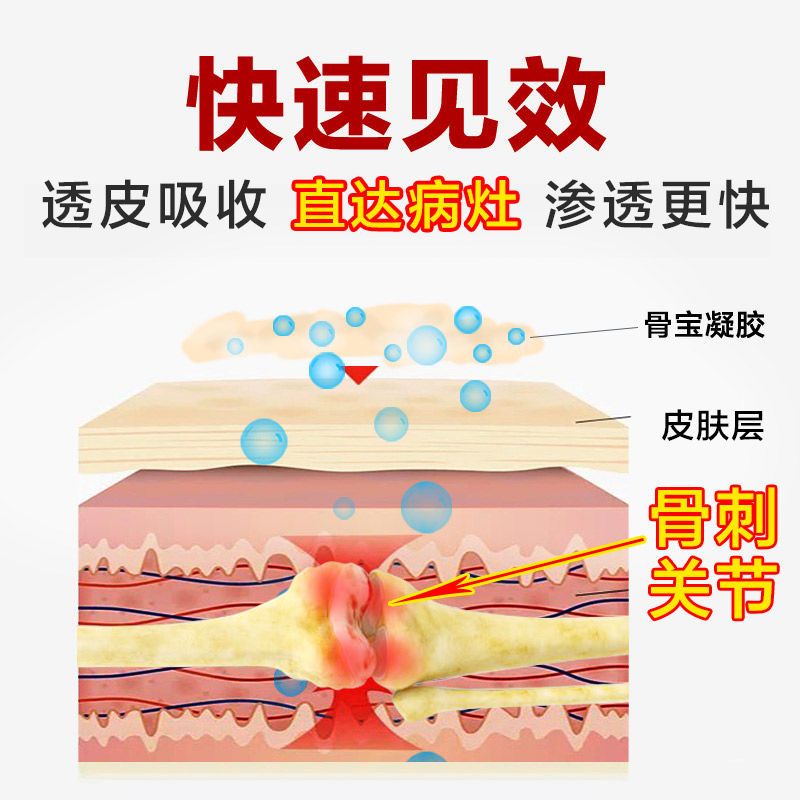 骨质增生专用膏贴骨刺膏贴颈椎贴去膝盖腰间盘骨质增生理疗贴膏 一盒乔记骨质增生关节型专用骨宝凝胶