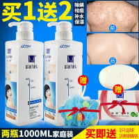 满婷(Manting)除螨后背部祛痘痘沐浴露螨婷男女去螨虫鸡皮肤疙瘩净螨家庭装