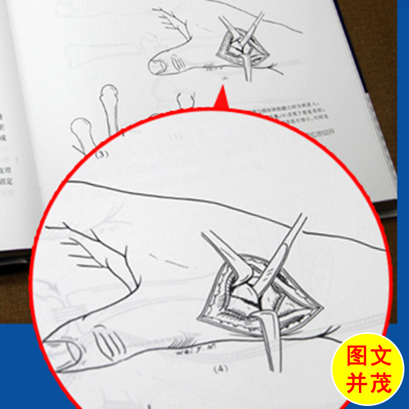 [正版] 韦加宁手外科手术图谱 韦加宁 外科医师外科手术参考书籍 韦加宁外科学书籍 人民卫生出版社 外科手术学 外科疾高清大图