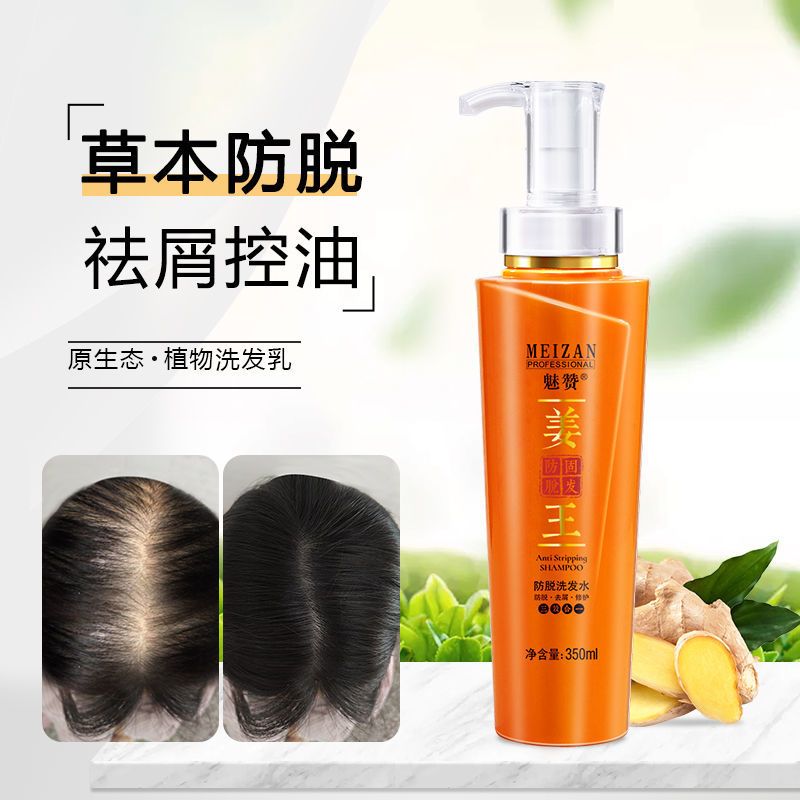 [防脱加强版]姜汁育发洗发水 [3瓶一周期]老姜王洗发乳防脱育发增发去屑控油植物洗发水男女