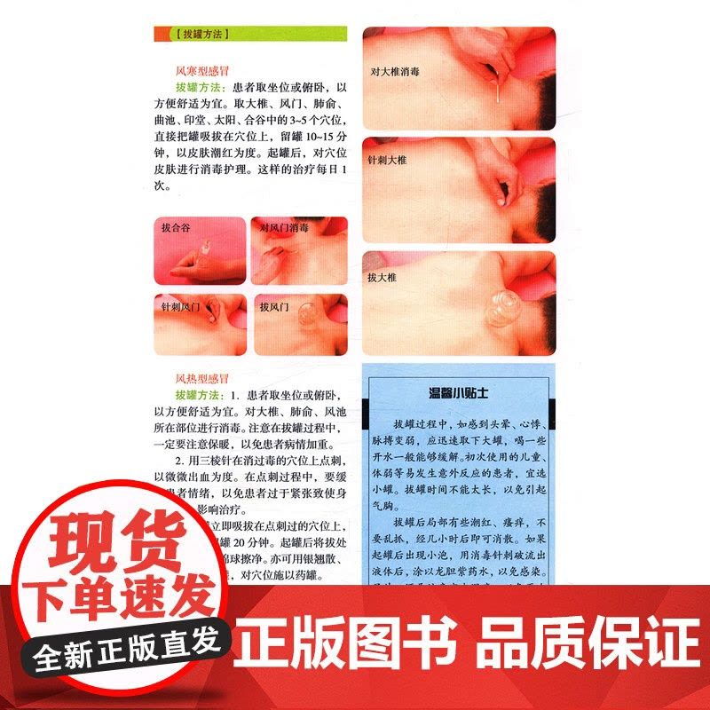 [2册]罐到病除对症拔罐祛百病+常见病对症拔罐速查手册 书籍图片