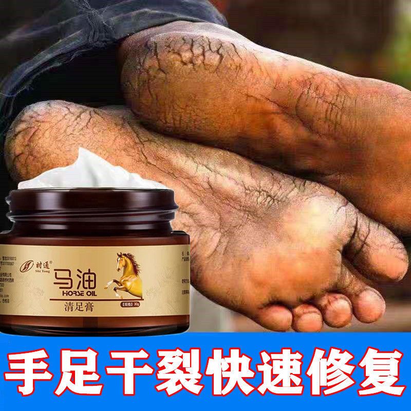 护手霜1支/---\ 马油干裂脚后跟皮手脚干燥开裂手足皲裂防裂膏护手护脚修护霜