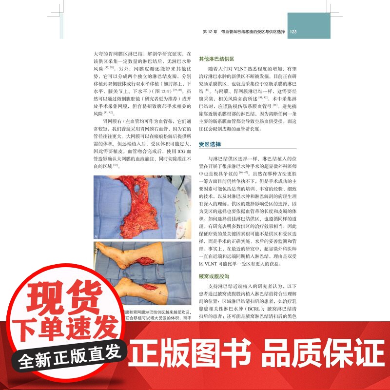 淋巴水肿外科原则与手术技巧 上海科技出版社多国权威专家诊治经验研究指南参考治疗方法理念领域手术技巧高清大图