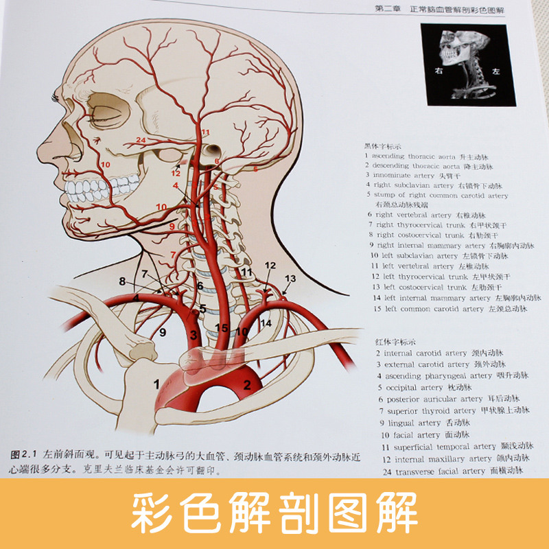 [醉染正版]脑血管解剖及病理三维血管造影图谱(精装彩图)人体脑血管解剖学图谱神经外科医生技术参考书动脉静脉医学书 辽宁科高清大图