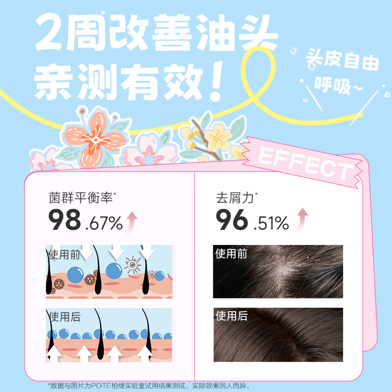 柏缇轻蓬控油洗发露380ml(单位:瓶)高清大图