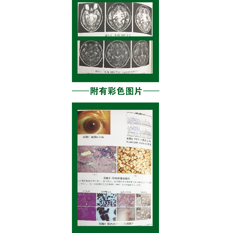 正版 神经内科医师查房手册 李智文//王柠 化学工业 978712214342高清大图