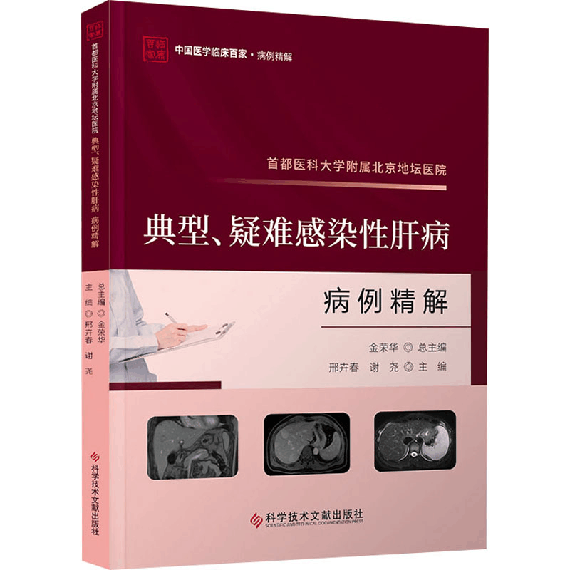 [M]首都医科大学附属北京地坛医院典型、疑难感染性肝病病例精解-9787523511817图片