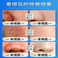 海洋主义水杨酸面膜补水睡眠清洁泥膜刷酸淡化痘印去黑头粉刺涂抹式