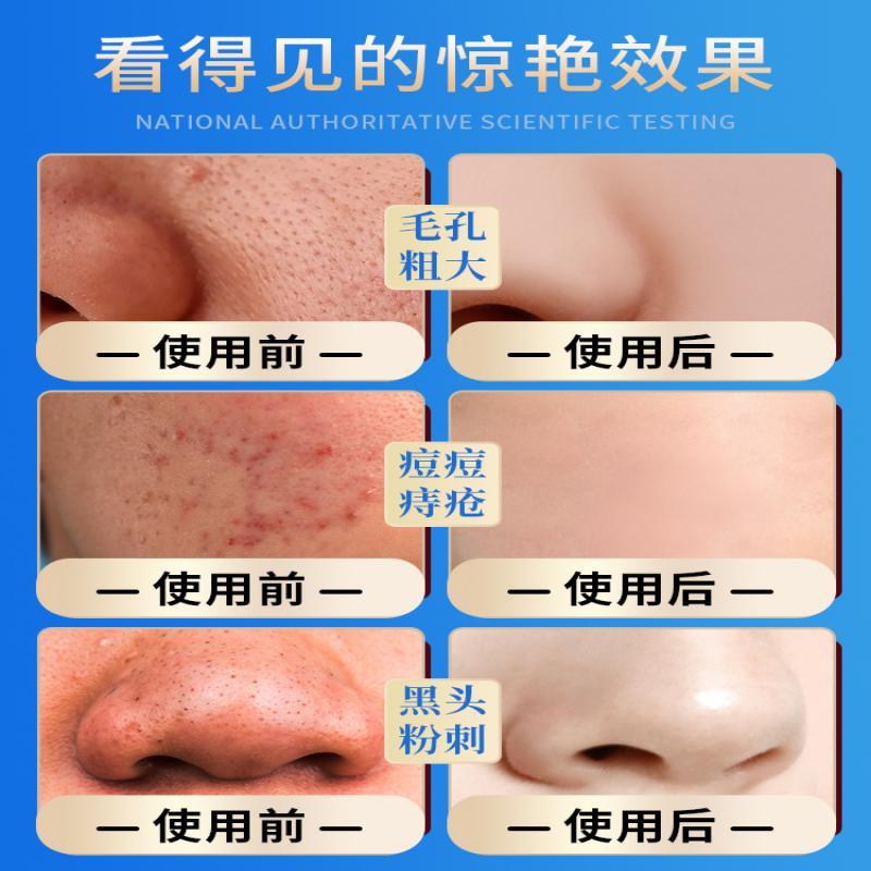 海洋主义水杨酸面膜补水睡眠清洁泥膜刷酸淡化痘印去黑头粉刺涂抹式