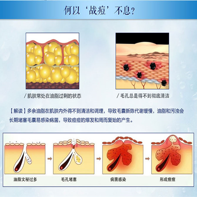 (2件5折)片仔癀清痘水100ml爽肤水(女士男士通用)改善青春痘改善粉刺改善毛孔粗大锁水补水保湿护肤品官方正品高清大图