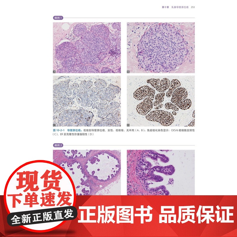 乳腺组织病理学图谱 上下册 乳腺组织学 乳腺疾病 病例讨论 高清图解 北京科学技术高清大图