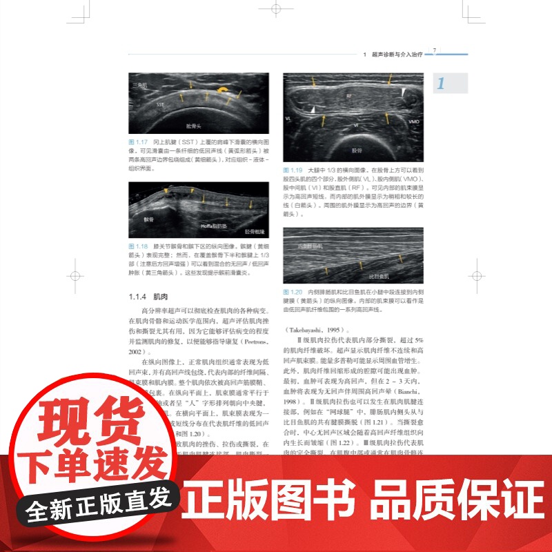 肌肉骨骼超声诊断与介入治疗实用指南 临床医生超声操作指南上海科学技术出版社临床医学外科学肌肉骨骼介入运动医学关节外科高清大图