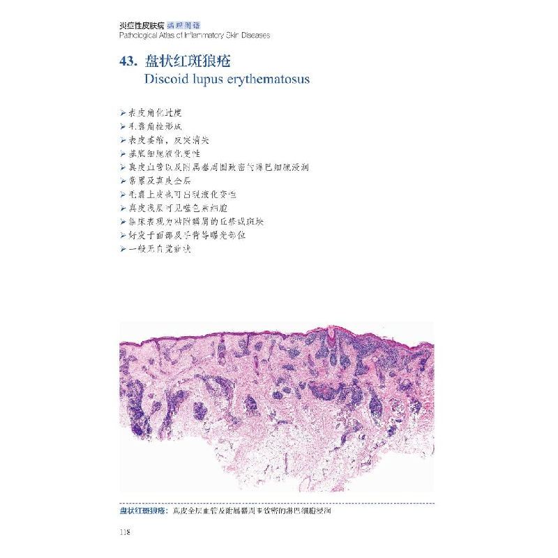 正版 炎症性皮肤病病理图谱(精) 常建民编著 北京大学医学出版社高清大图