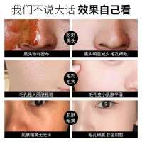 碧素堂撕拉式面膜去黑头粉刺去螨虫深层清洁控油祛痘男女通用面膜 [清洁黑头粉刺]1支撕拉面膜
