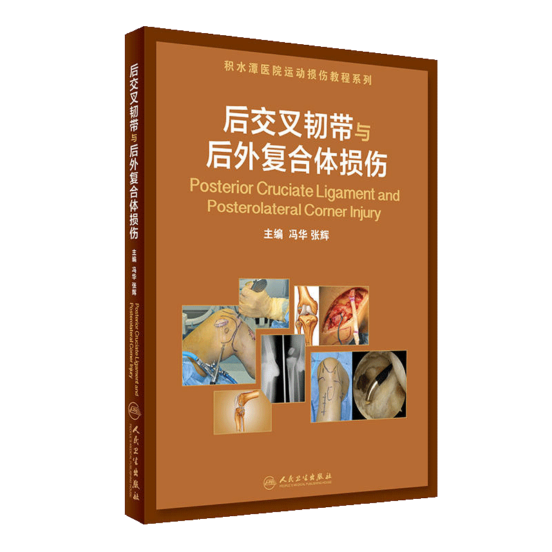 [正版]医学书后交叉韧带与后外复合体损伤高清大图