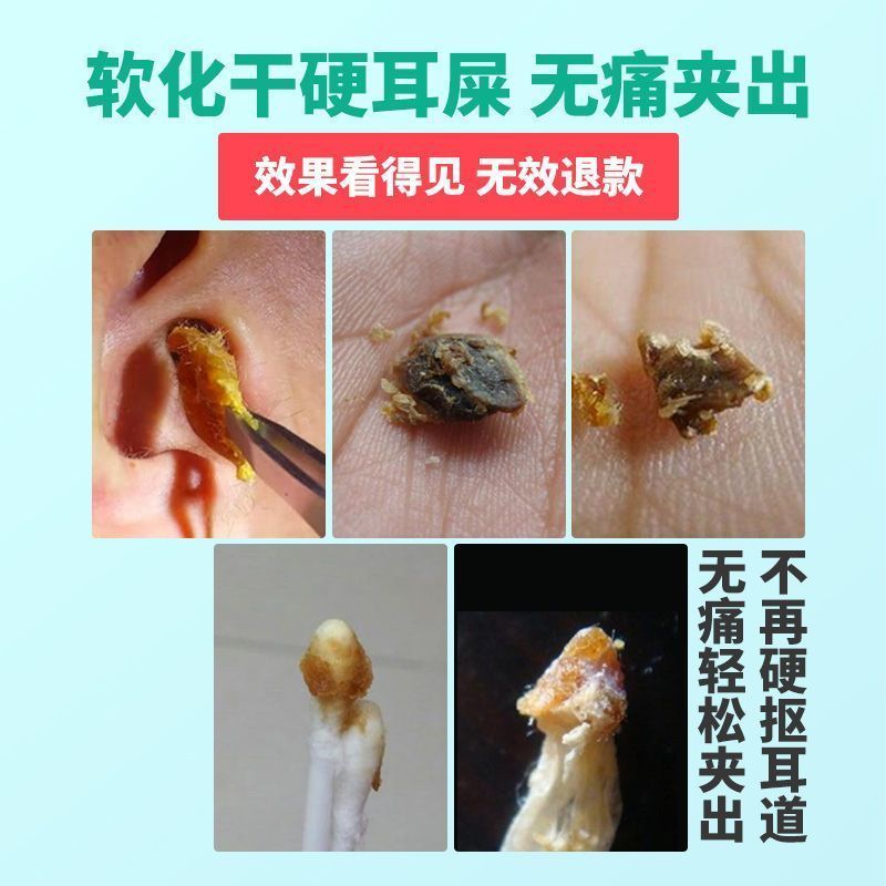 滴耳液人用碳酸氢钠盯眝水耳朵清洁器儿童成人软化硬耳屎耳垢洁耳滴耳